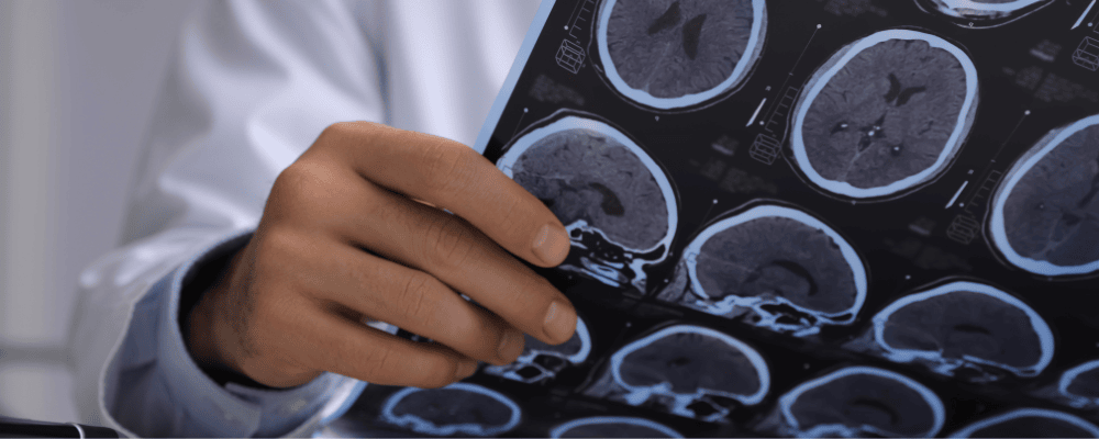 Doctor holding images of a brain scan.
